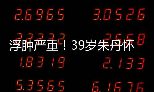 带货7个朱丹直播严重月 9岁深夜怀孕浮肿坚持